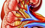Кто лечит тромбоз почечной артерии