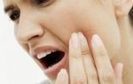 При зубной боли повышается артериальное давление