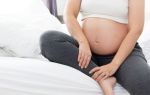 Острый тромбоз глубоких вен при беременности