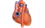 Артериальное давление и левый желудочек сердца