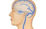 Асептический тромбоз синусов головного мозга